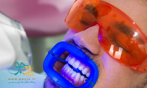 بلیچینگ دندان چگونه باعث سفیدی دندان میشود؟ روشهای سفید کردن دندان
