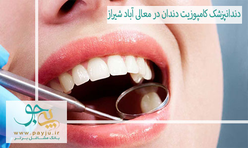 بهترین دندانپزشک کامپوزیت دندان در معالی آباد شیراز