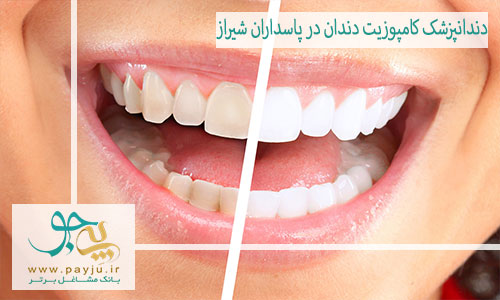 بهترین دندانپزشک کامپوزیت دندان در پاسداران شیراز