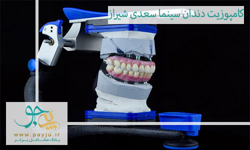 بهترین دندانپزشک کامپوزیت دندان در سینما سعدی شیراز