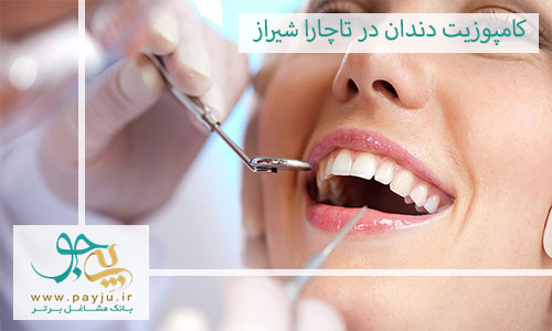 بهترین دندانپزشک کامپوزیت دندان در تاچارا شیراز