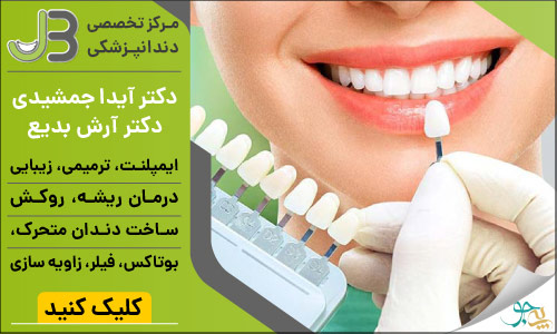لیست دندانپزشکان متخصص ایمپلنت در شیراز
