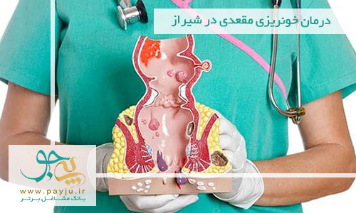درمان خونریزی مقعدی در شیراز