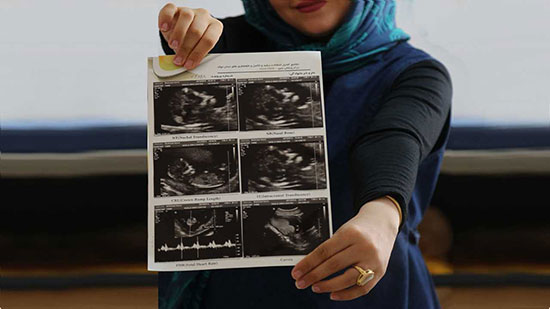 ایده‌های جذاب اعلام خبر بارداری به همسر